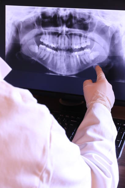 Best Emergency Wisdom Teeth Removal in Delafield, WI