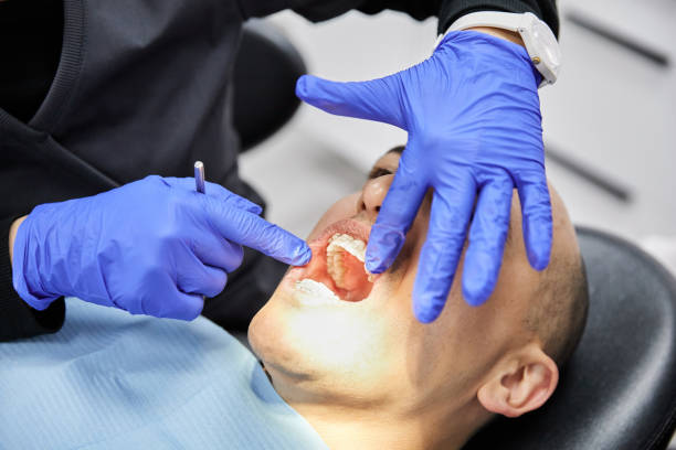 Best Emergency Tooth Extraction in Delafield, WI