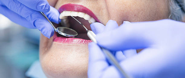 Best Emergency Tooth Extraction in Delafield, WI